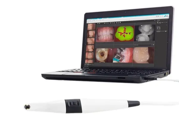 VistaCam iX HD, inkl. Cam-Wechselkopf, Packung à 1 Set